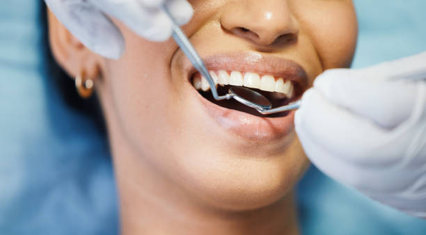 Best Emergency Dental Care for Broken or Chipped Teeth in Parsons, KS