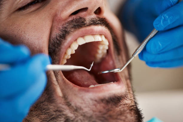 Best Emergency Dental Care for Broken or Chipped Teeth in Parsons, KS